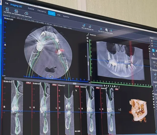 Pianificazione 3D di un impianto sul monitor